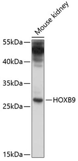 Western blot - HOXB9 antibody (A10222)