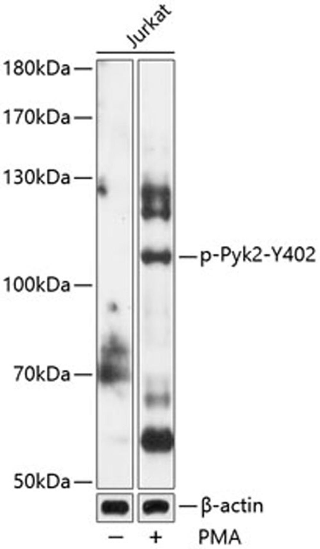 Western blot - Phospho-Pyk2-Y402 antibody (AP0612)