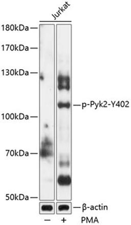 Western blot - Phospho-Pyk2-Y402 antibody (AP0612)