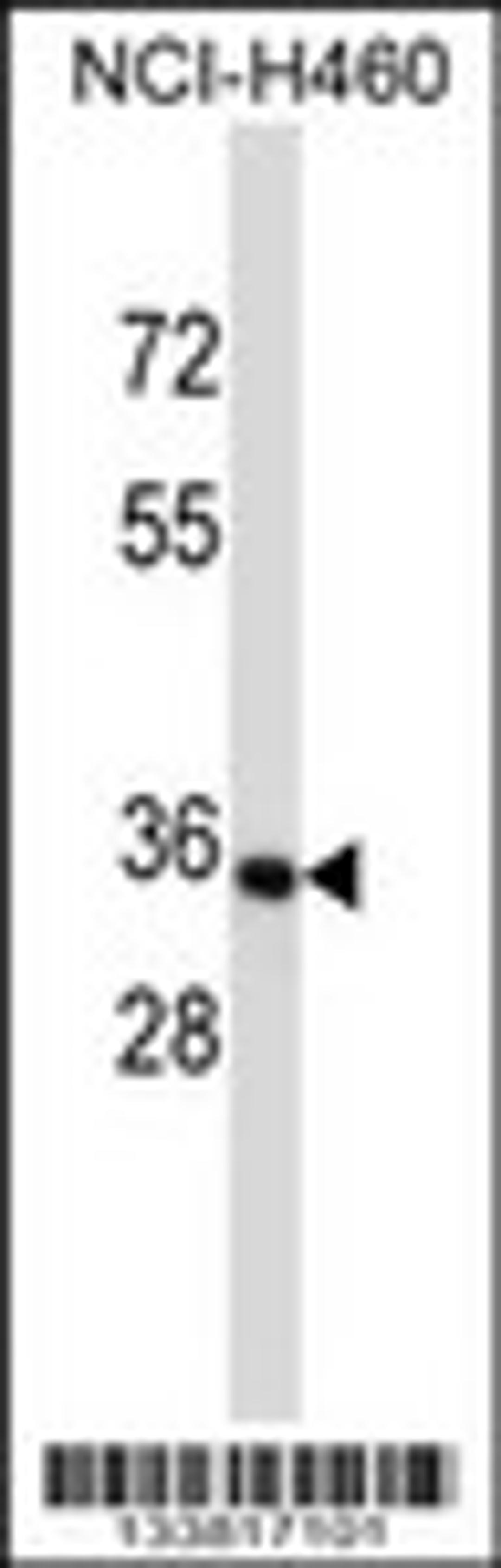 Western blot analysis in NCI-H460 cell line lysates (35ug/lane).