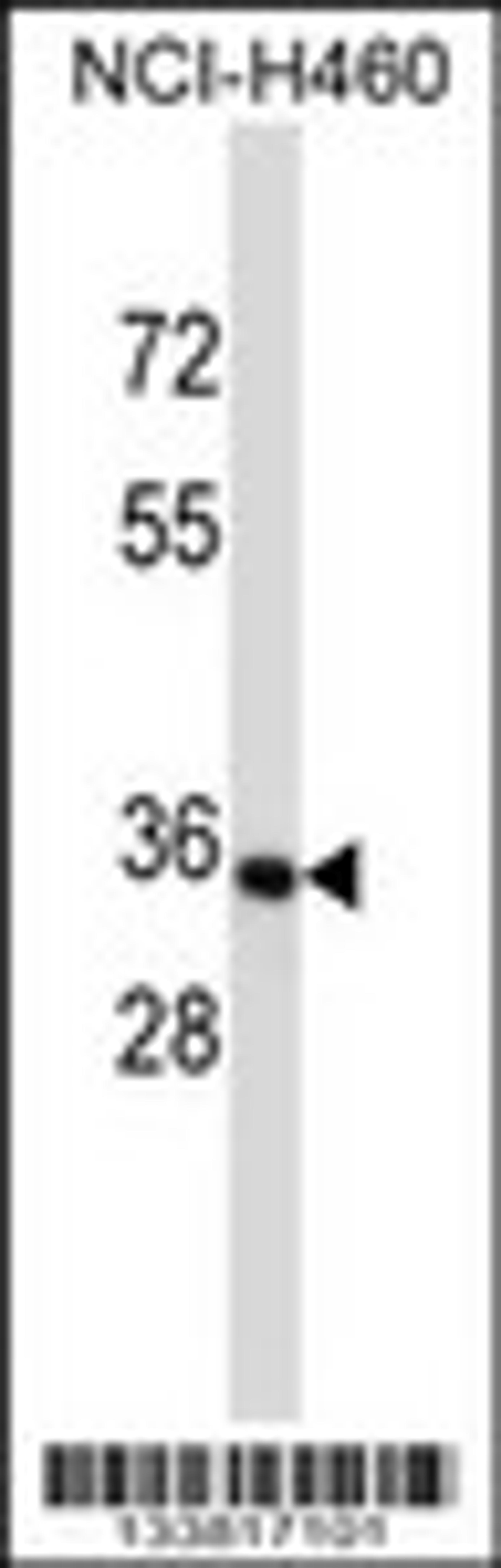 Western blot analysis in NCI-H460 cell line lysates (35ug/lane).