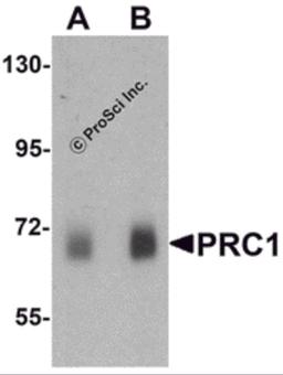 Western blot analysis of PRC1 in human skeletal muscle tissue lysate with Prc1 antibody at (A) 0.5 μg/ml and (B) 1 μg/mL.