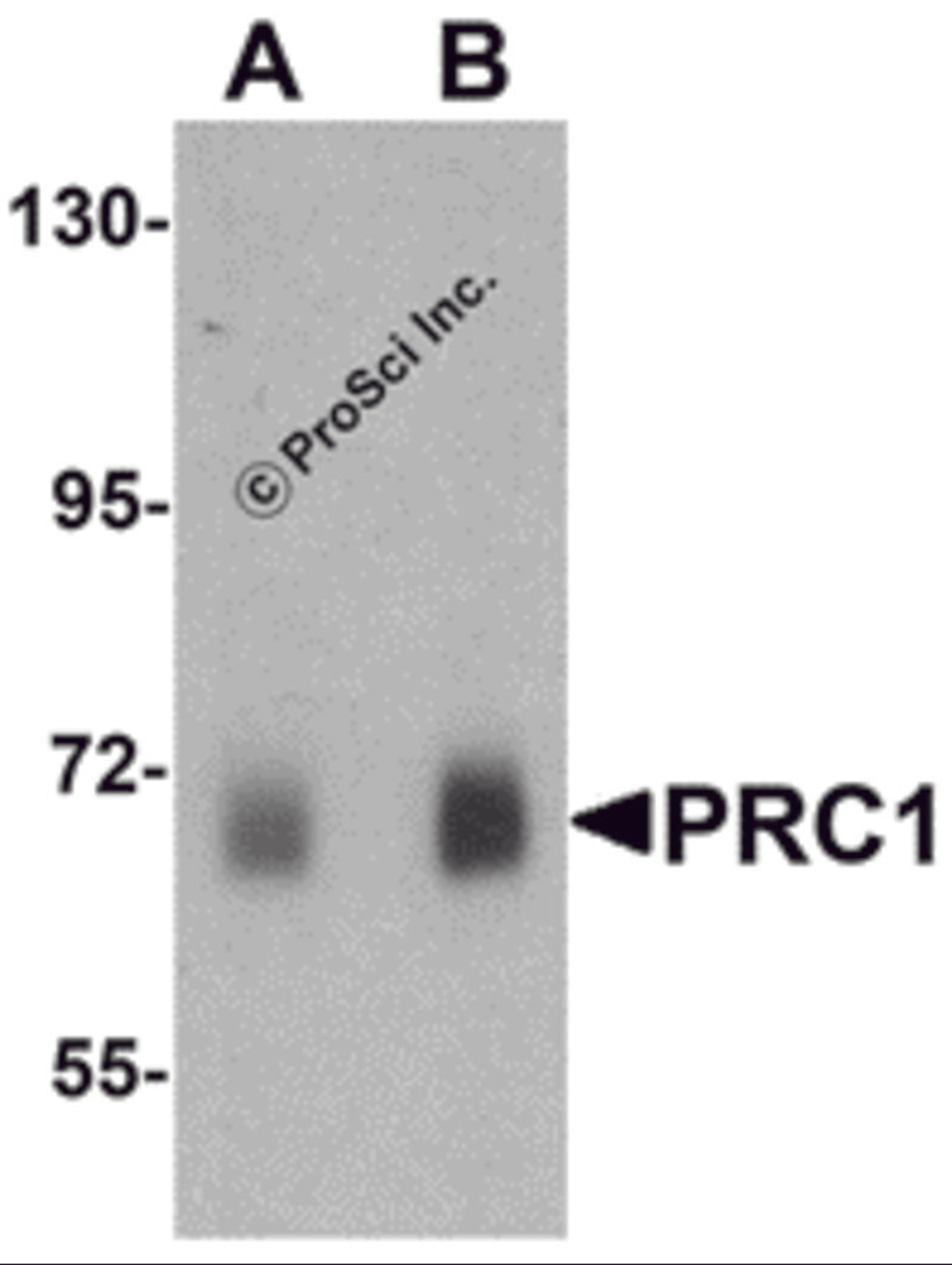 Western blot analysis of PRC1 in human skeletal muscle tissue lysate with Prc1 antibody at (A) 0.5 μg/ml and (B) 1 μg/mL.