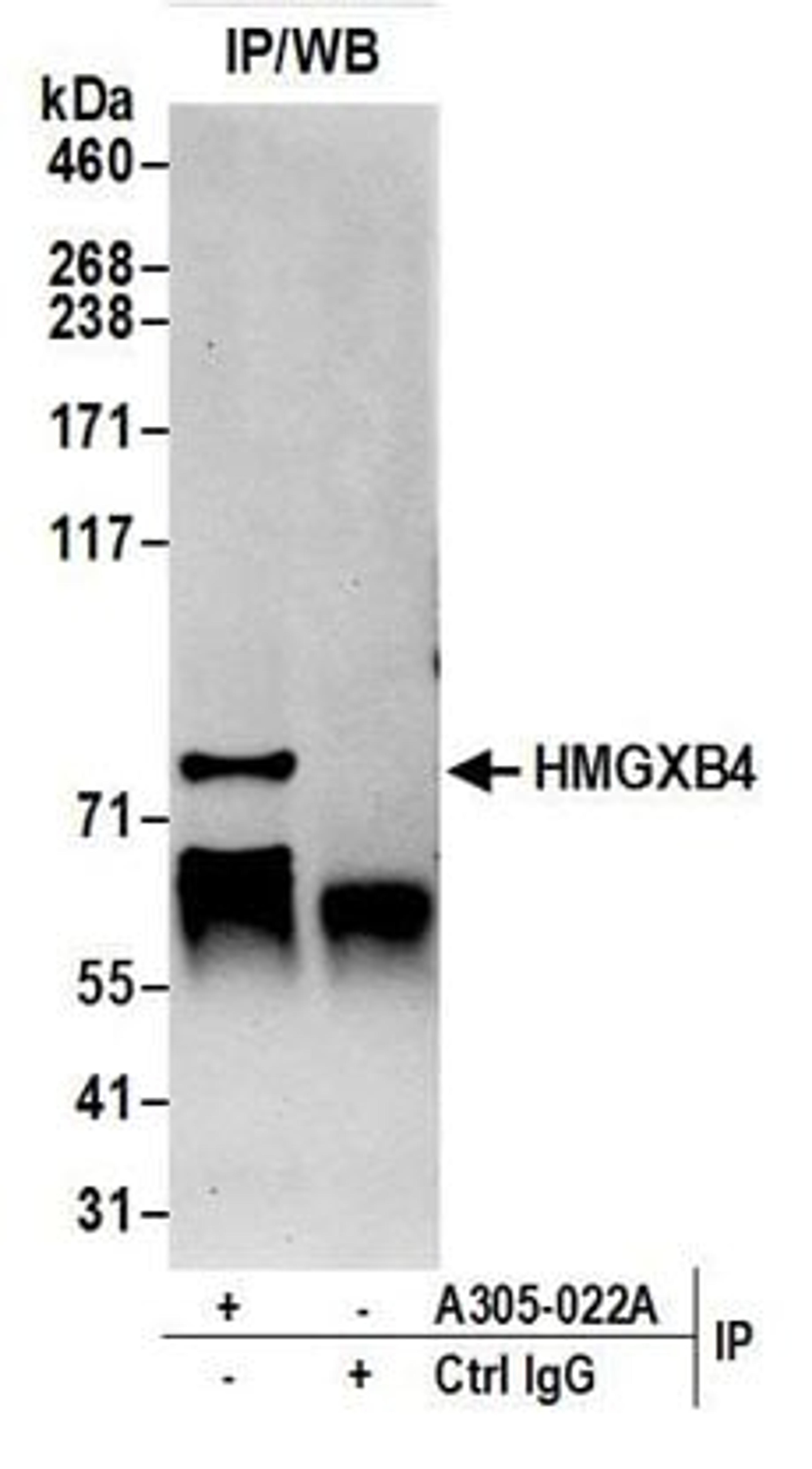 Detection of human HMGXB4 by western blot of immunoprecipitates.