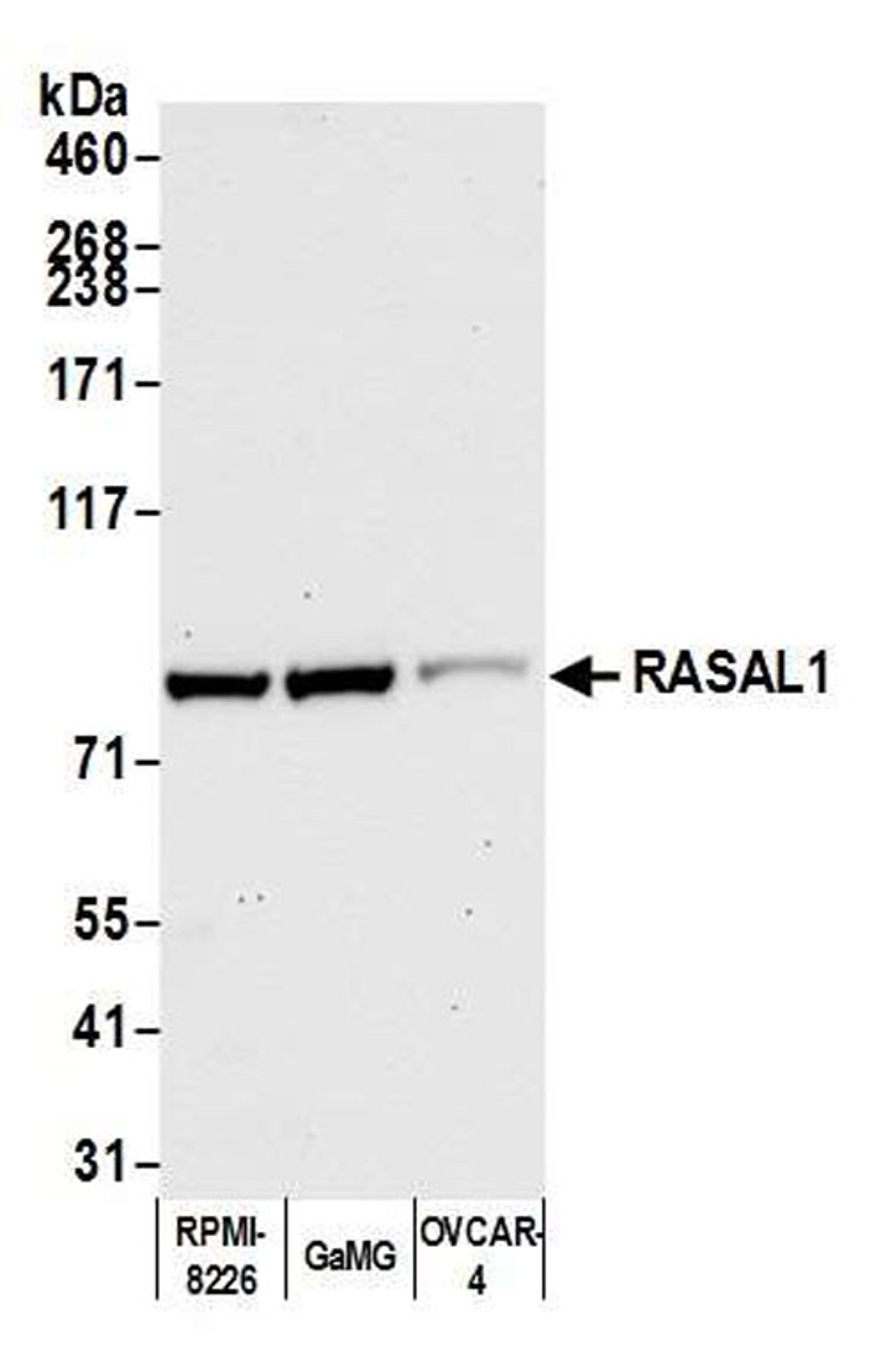 Detection of human RASAL1 by WB.