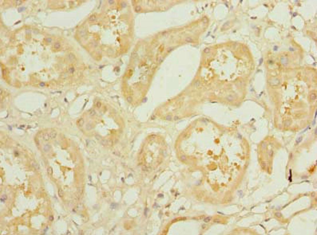 Immunohistochemistry of paraffin-embedded human kidney tissue using CSB-PA885803LA01HU at dilution of 1:100