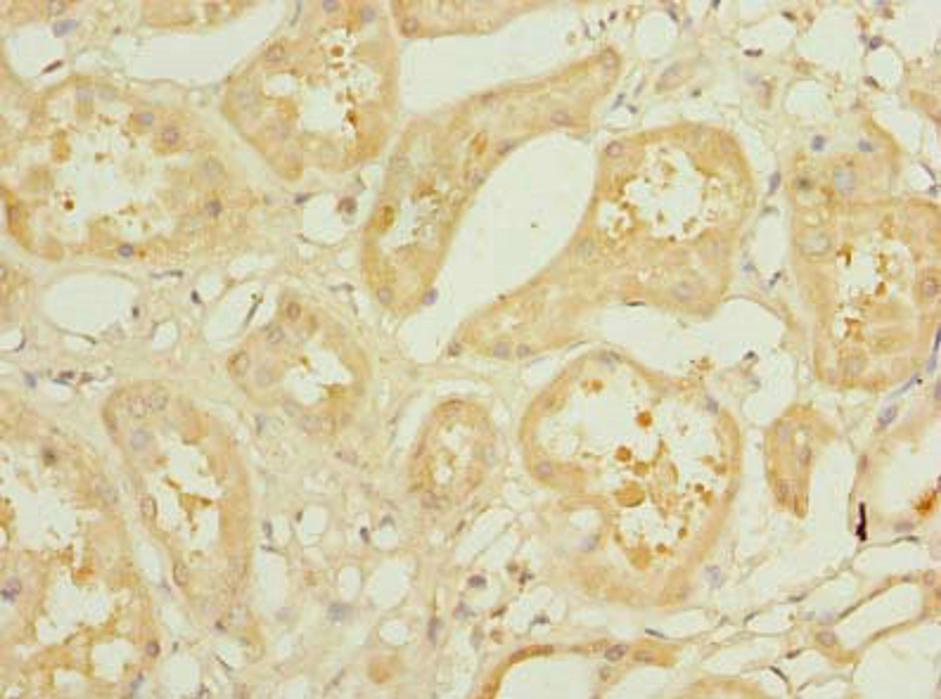 Immunohistochemistry of paraffin-embedded human kidney tissue using CSB-PA885803LA01HU at dilution of 1:100