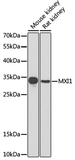 Western blot - MXI1 antibody (A6661)