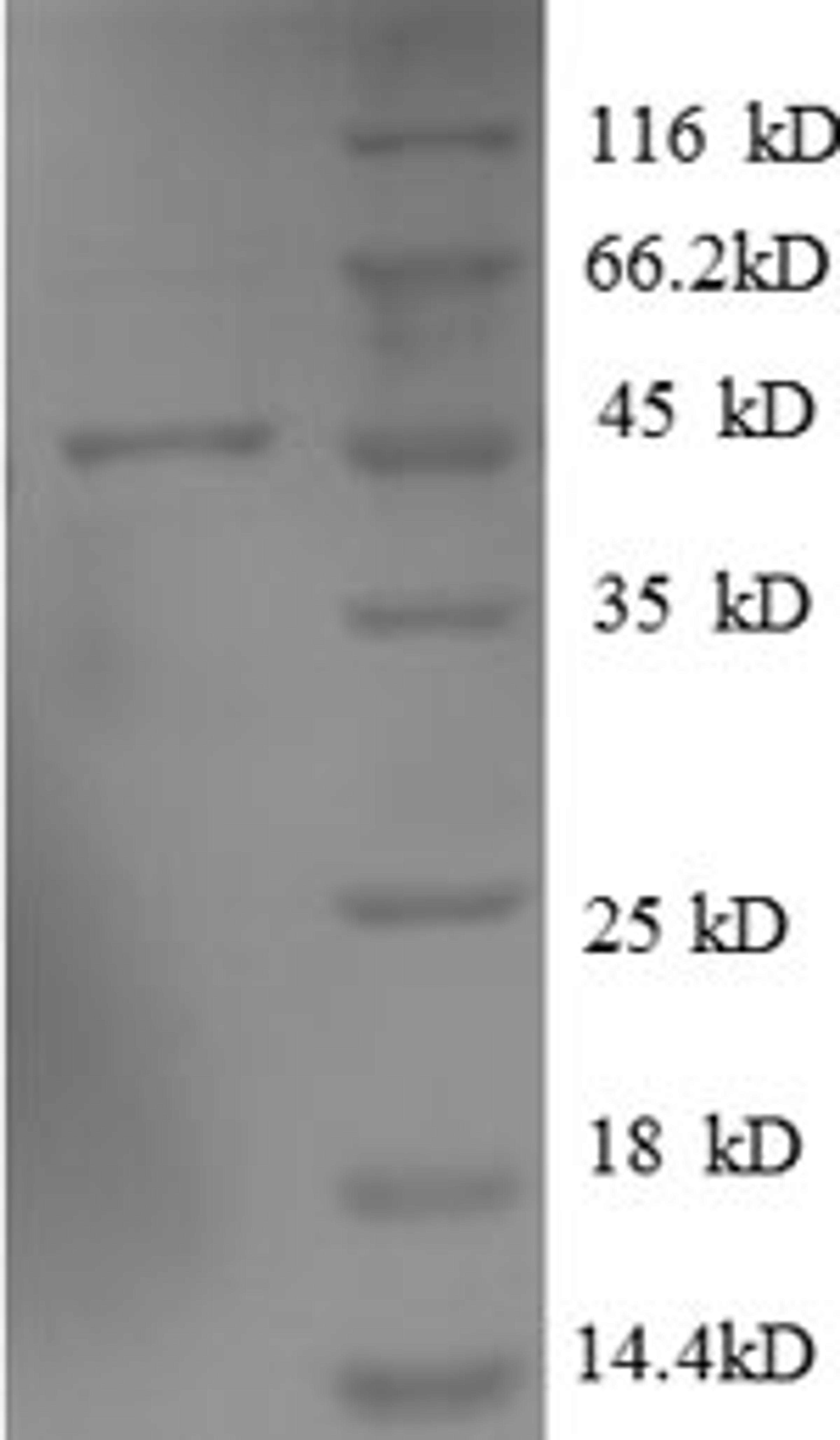 (Tris-Glycine gel) Discontinuous SDS-PAGE (reduced) with 5% enrichment gel and 15% separation gel.