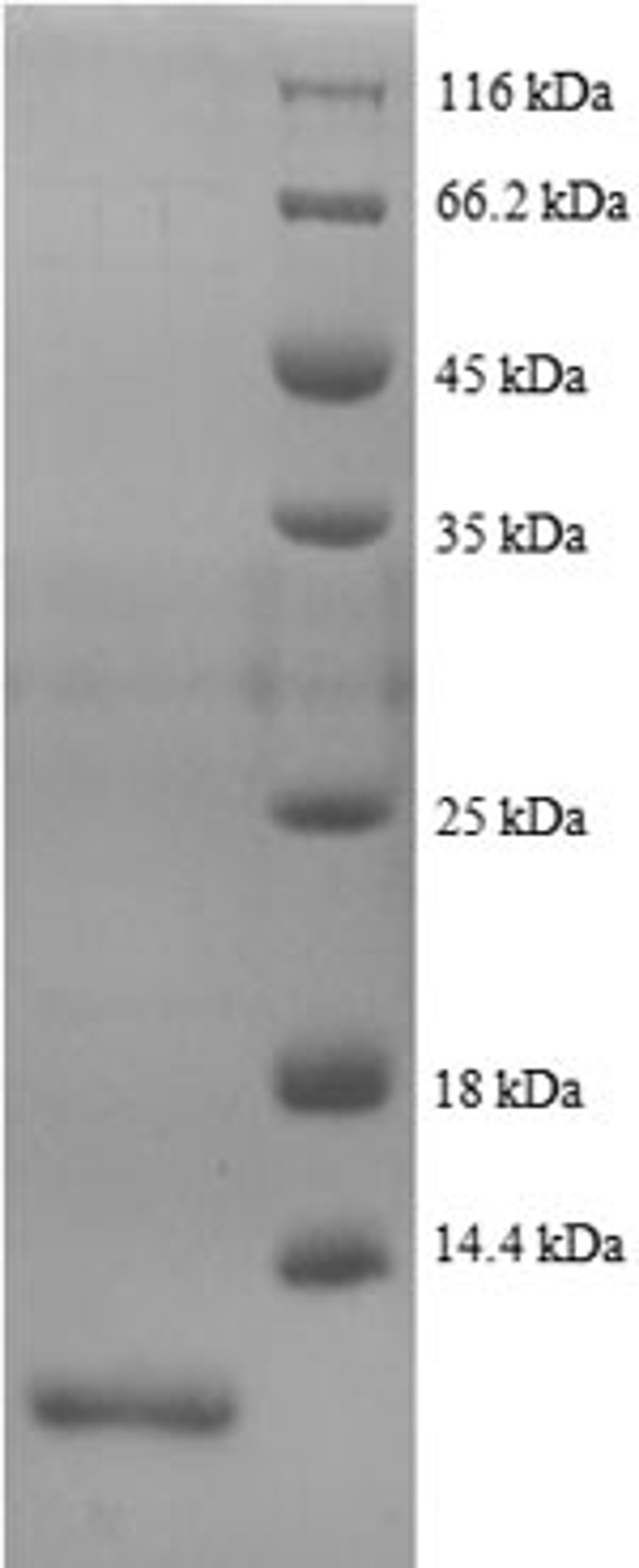 (Tris-Glycine gel) Discontinuous SDS-PAGE (reduced) with 5% enrichment gel and 15% separation gel.