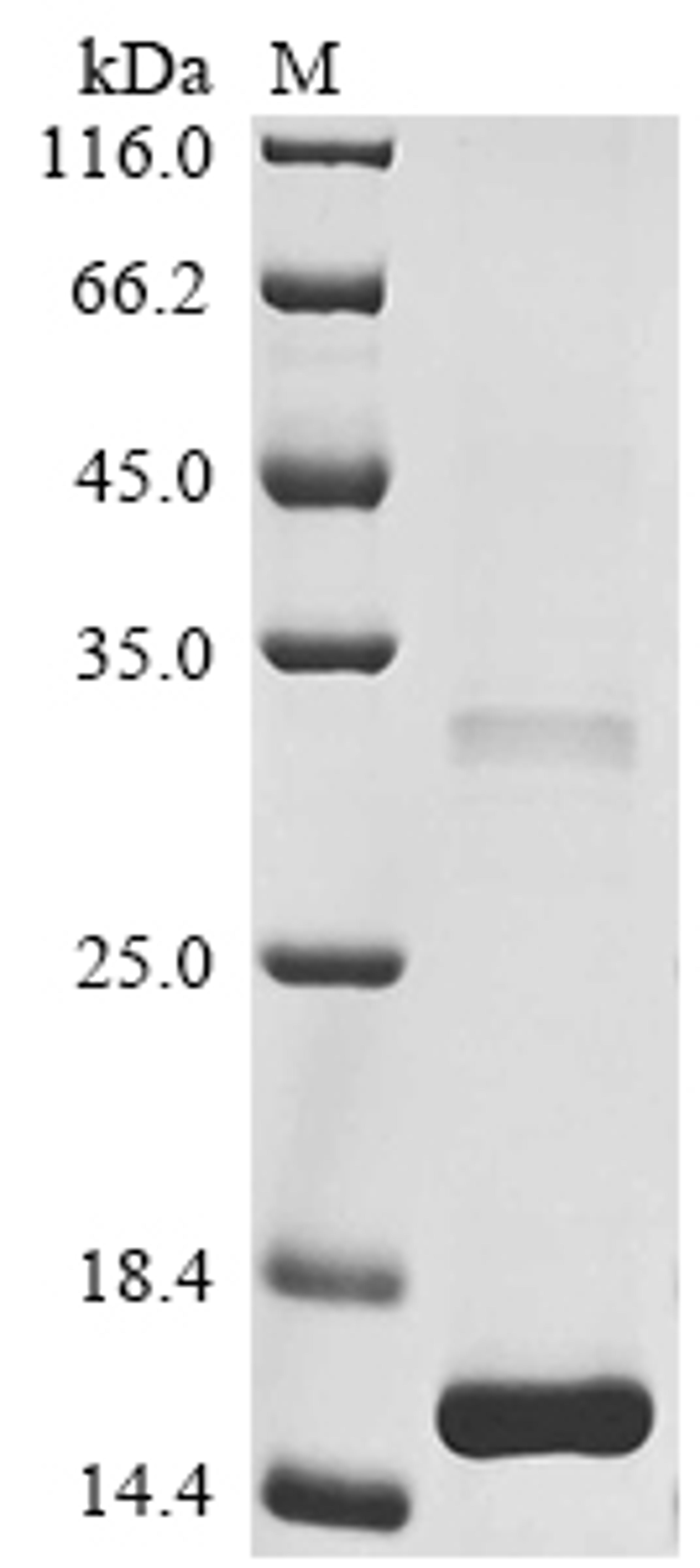 (Tris-Glycine gel) Discontinuous SDS-PAGE (reduced) with 5% enrichment gel and 15% separation gel.