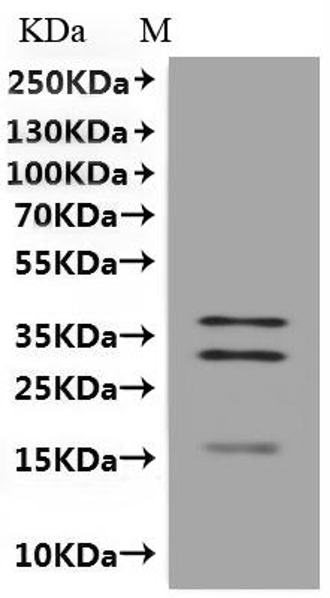 CSB-MP890691HU is detected by Mouse anti-6*His monoclonal antibody.