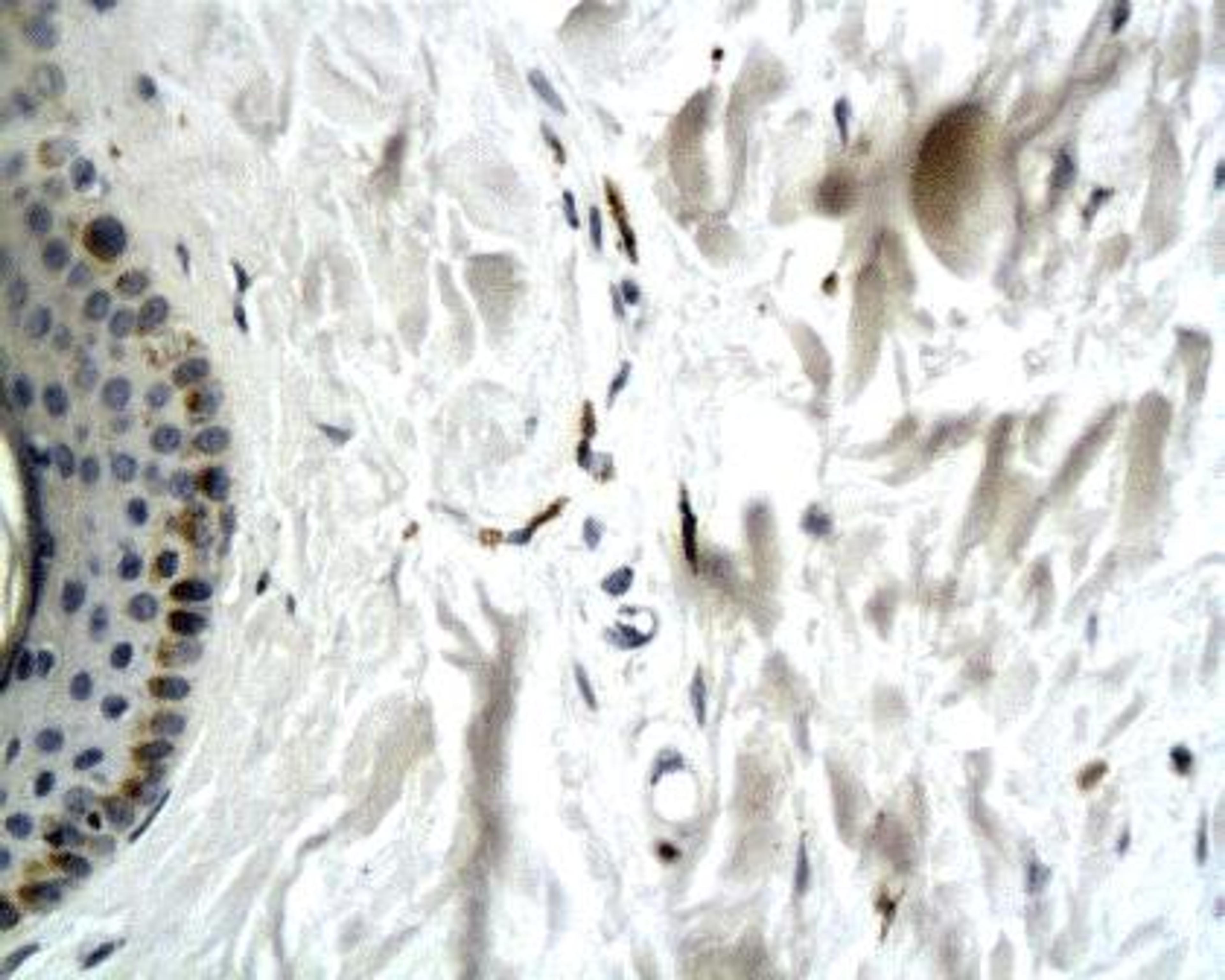 Immunohistochemical staining of paraffin embedded scalp tissue using Collagen VII antibody