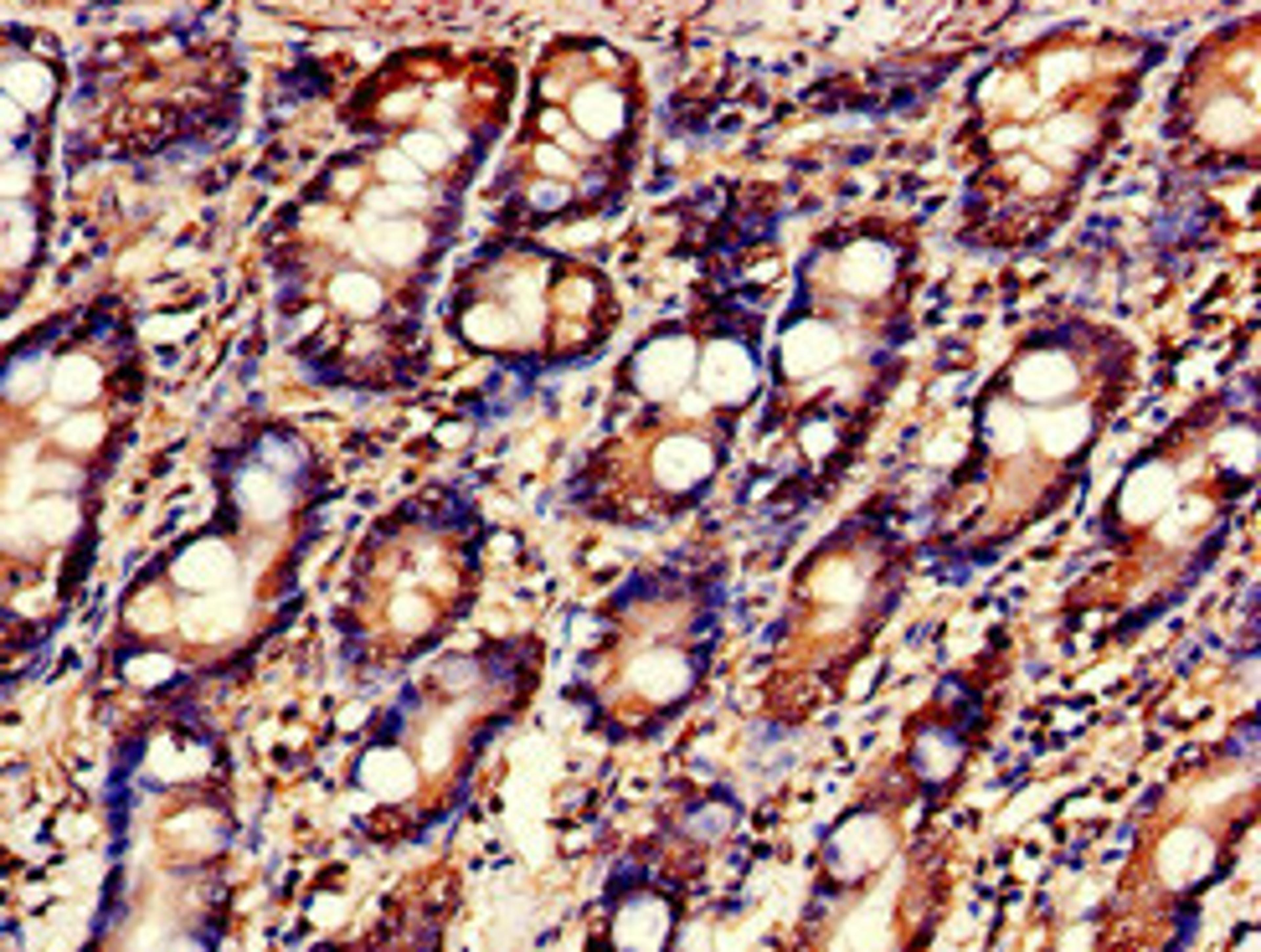 Immunohistochemistry of paraffin-embedded human small intestine tissue using CSB-PA013498LA01HU at dilution of 1:100