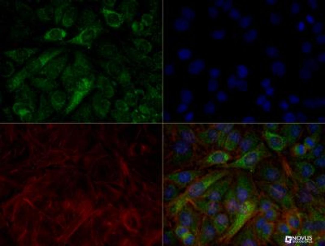 Immunocytochemistry/Immunofluorescence: PINK1 Antibody (8E10.1D6) [NBP2-36488] - HeLa cells were treated with valinomycin (1 uM for 24h) prior to being fixed in 10% buffered formalin for 10 min and permeabilized in 0.1% triton X-100 in PBS for 10 min.  Cells were incubated with NBP2-36488 at 50 ug/ml for 1h at room temperature, washed 3x in PBS and incubated with Alexa-Dylight-488 anti-mouse secondary antibody.  PINK1 (Green) was detected at the mitochondria.  Tubulin (Red) was detected using an anti-tubulin antibody with an anti-rabbit DyLight 550 secondary antibody.  DNA (Blue) was counterstained with DAPI.  Note: mitochondria staining might not be easily observed without treatment with valinomycin or CCCP.  Image objective 40x.