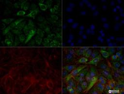 Immunocytochemistry/Immunofluorescence: PINK1 Antibody (8E10.1D6) [NBP2-36488] - HeLa cells were treated with valinomycin (1 uM for 24h) prior to being fixed in 10% buffered formalin for 10 min and permeabilized in 0.1% triton X-100 in PBS for 10 min.  Cells were incubated with NBP2-36488 at 50 ug/ml for 1h at room temperature, washed 3x in PBS and incubated with Alexa-Dylight-488 anti-mouse secondary antibody.  PINK1 (Green) was detected at the mitochondria.  Tubulin (Red) was detected using an anti-tubulin antibody with an anti-rabbit DyLight 550 secondary antibody.  DNA (Blue) was counterstained with DAPI.  Note: mitochondria staining might not be easily observed without treatment with valinomycin or CCCP.  Image objective 40x.