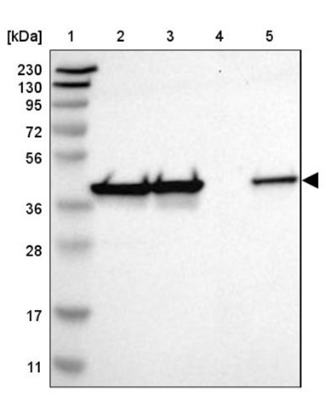 Western Blot: DNAJB12 Antibody [NBP1-85208] - Lane 1: Marker [kDa] 230, 130, 95, 72, 56, 36, 28, 17, 11<br/>Lane 2: Human cell line RT-4<br/>Lane 3: Human cell line U-251MG sp<br/>Lane 4: Human plasma (IgG/HSA depleted)<br/>Lane 5: Human liver tissue