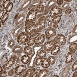 Immunohistochemistry: LATS1 Antibody [NBP1-86860] - Staining of human kidney shows strong cytoplasmic positivity in cells in tubules.