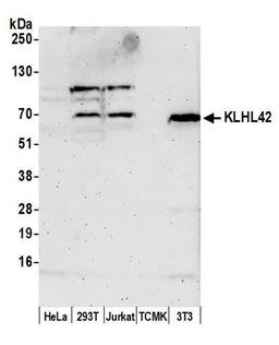 Detection of human and mouse KLHL42 by WB.