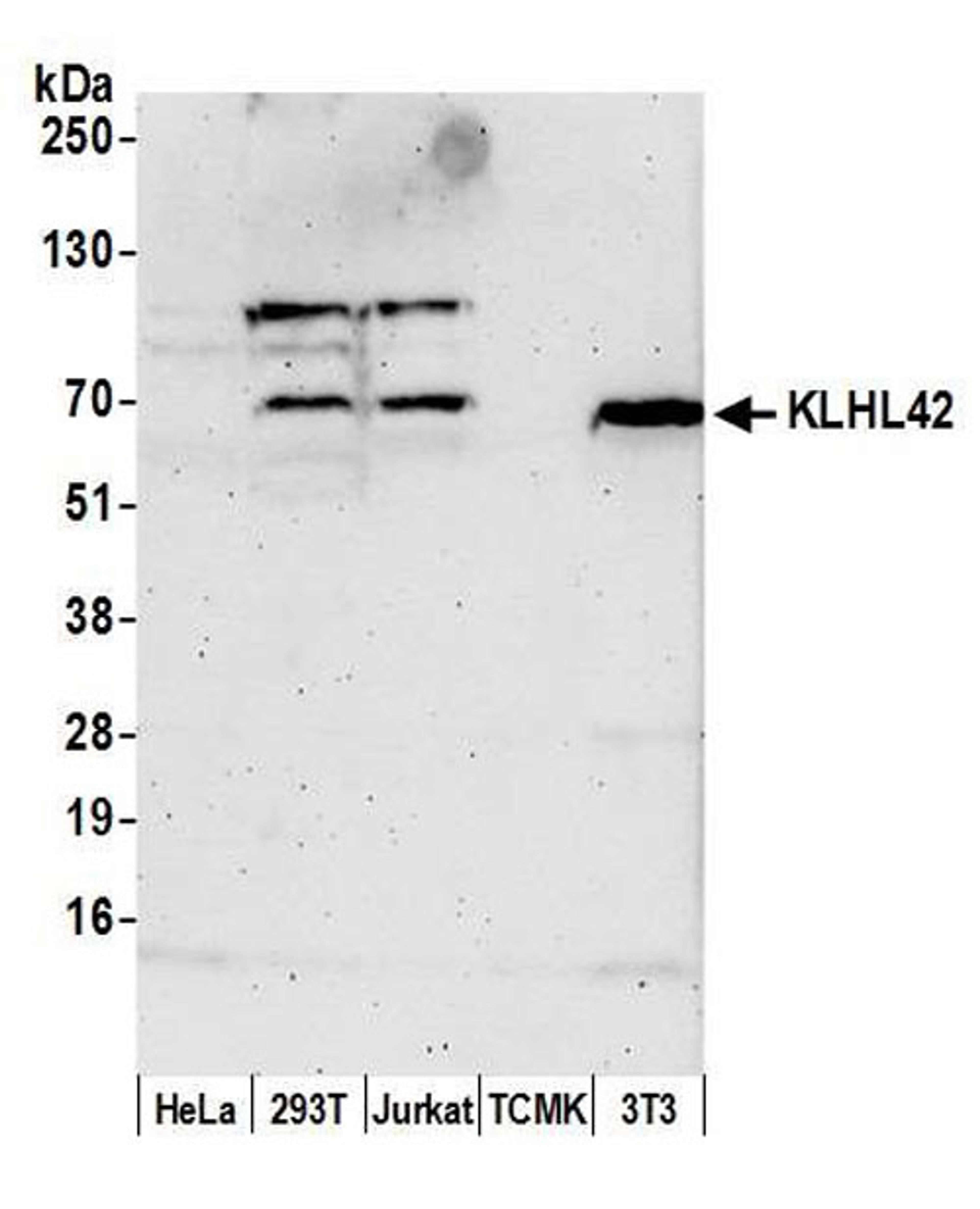 Detection of human and mouse KLHL42 by WB.