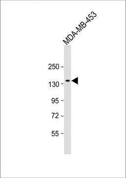 Western Blot at 1:1000 dilution + MDA-MB-453 whole cell lysate Lysates/proteins at 20 ug per lane.