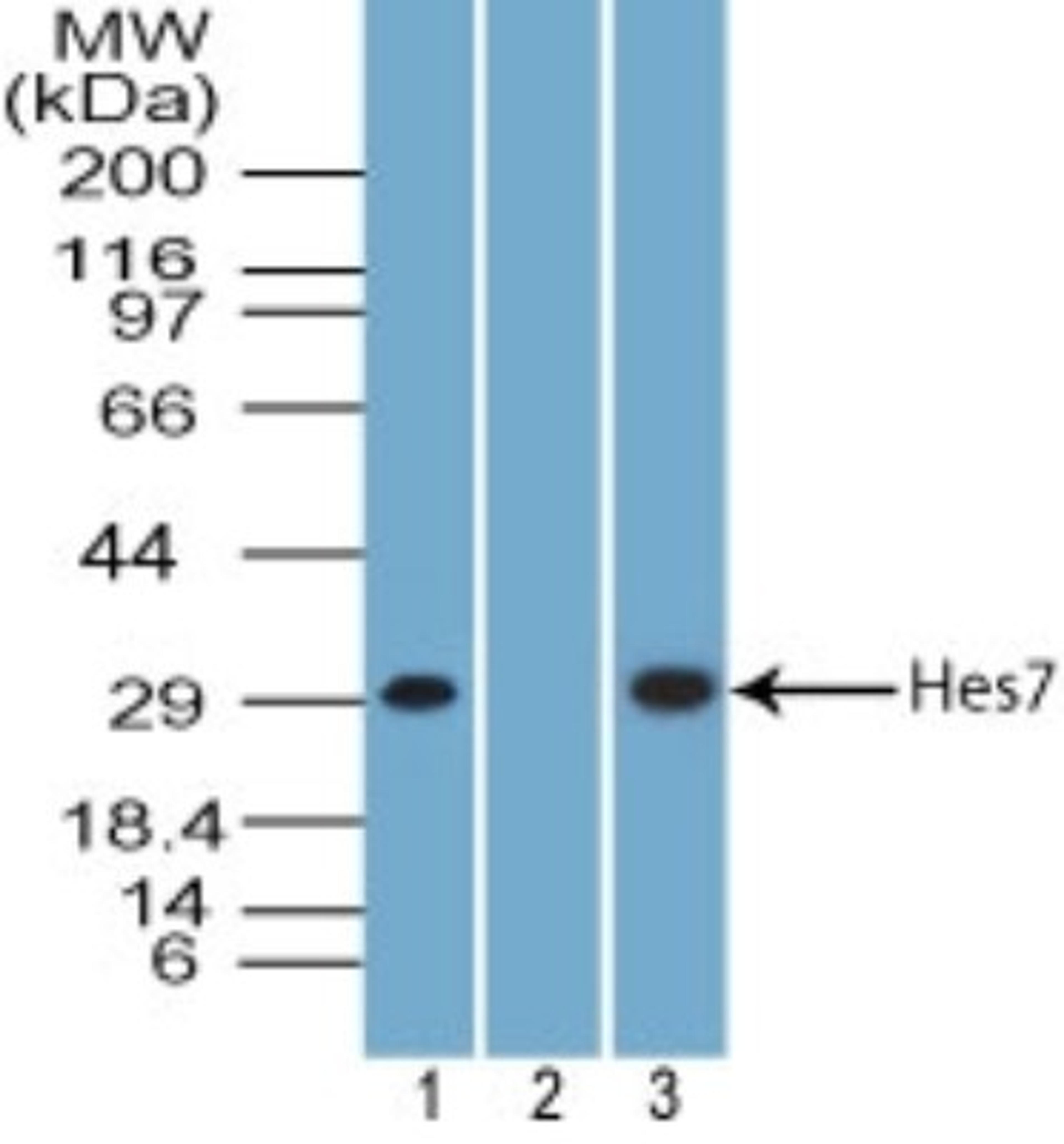 Western Blot: HES7 Antibody [NBP2-27417] - analysis of HES7 using HES7 antibody. Mouse C2C12 lysate in the 1) absence and 2) presence of immunizing peptide and 3) NIH 3T3 lysate probed with 3 and 6 ug/ml of HES7 antibody, respectively. I goat anti-rabbit Ig HRP secondary antibody and PicoTect ECL substrate solution were used for this test.