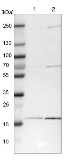 Western Blot: ZNHIT1 Antibody [NBP1-85673] - Lane 1: NIH-3T3 cell lysate (Mouse embryonic fibroblast cells)<br/>Lane 2: NBT-II cell lysate (Rat Wistar bladder tumour cells)