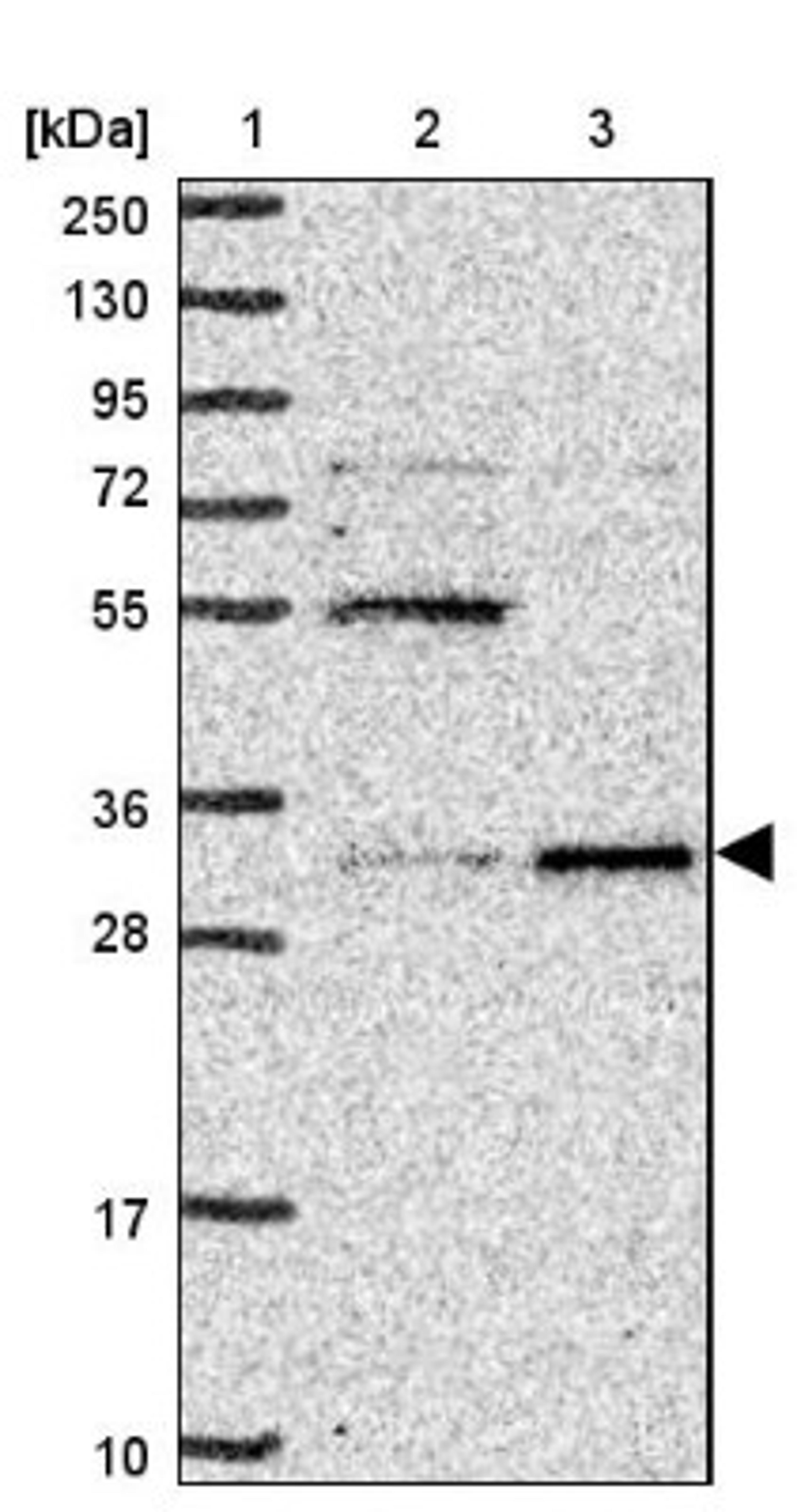 Western Blot: UCK Antibody [NBP2-47587] - Lane 1: Marker [kDa] 250, 130, 95, 72, 55, 36, 28, 17, 10.  Lane 2: Human cell line RT-4.  Lane 3: Human cell line U-251MG.