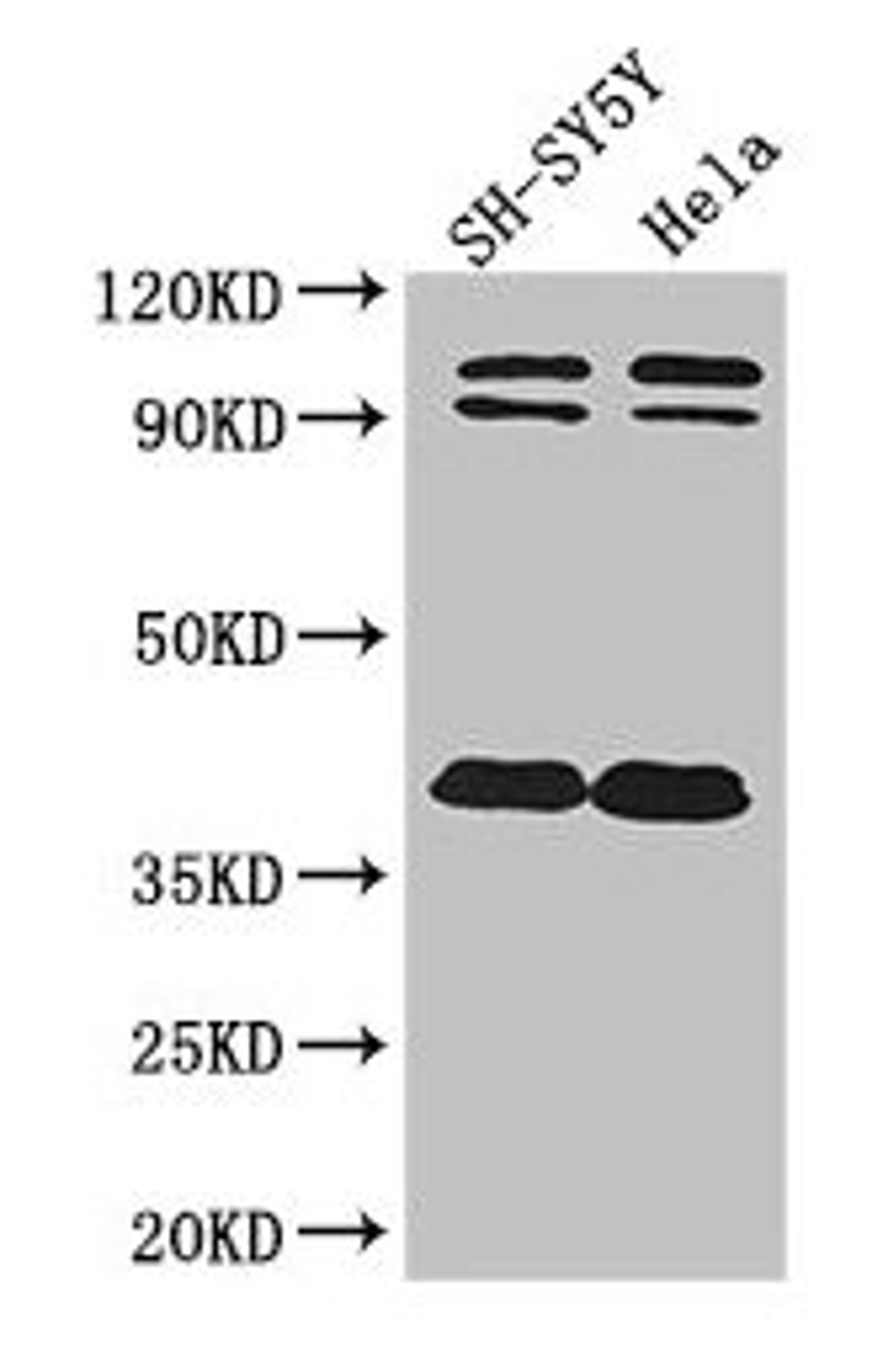 Western Blot. Positive WB detected in: SH-SY5Y whole cell lysate, Hela whole cell lysate. All lanes: DISC1 antibody at 2ug/ml. Secondary. Goat polyclonal to rabbit IgG at 1/50000 dilution. Predicted band size: 94, 92, 74, 39, 83, 63, 61, 76, 73, 38, 22 kDa. Observed band size: 94, 92, 38 kDa