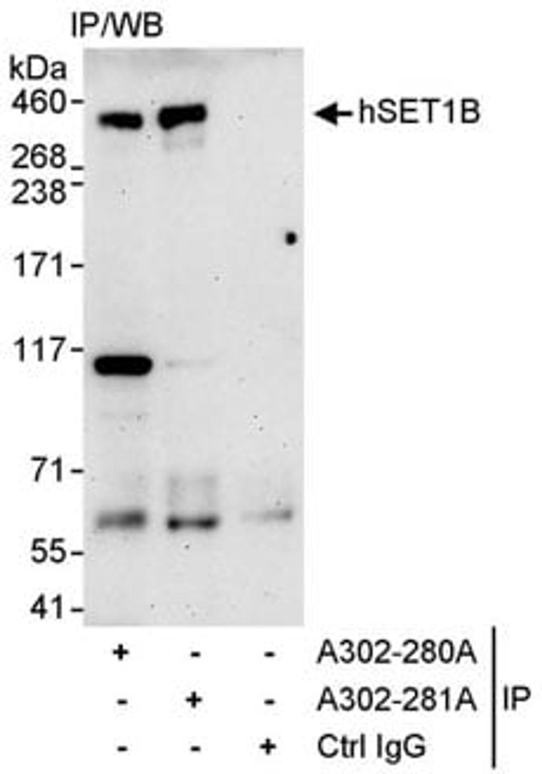 Detection of human hSET1B by western blot of immunoprecipitates.