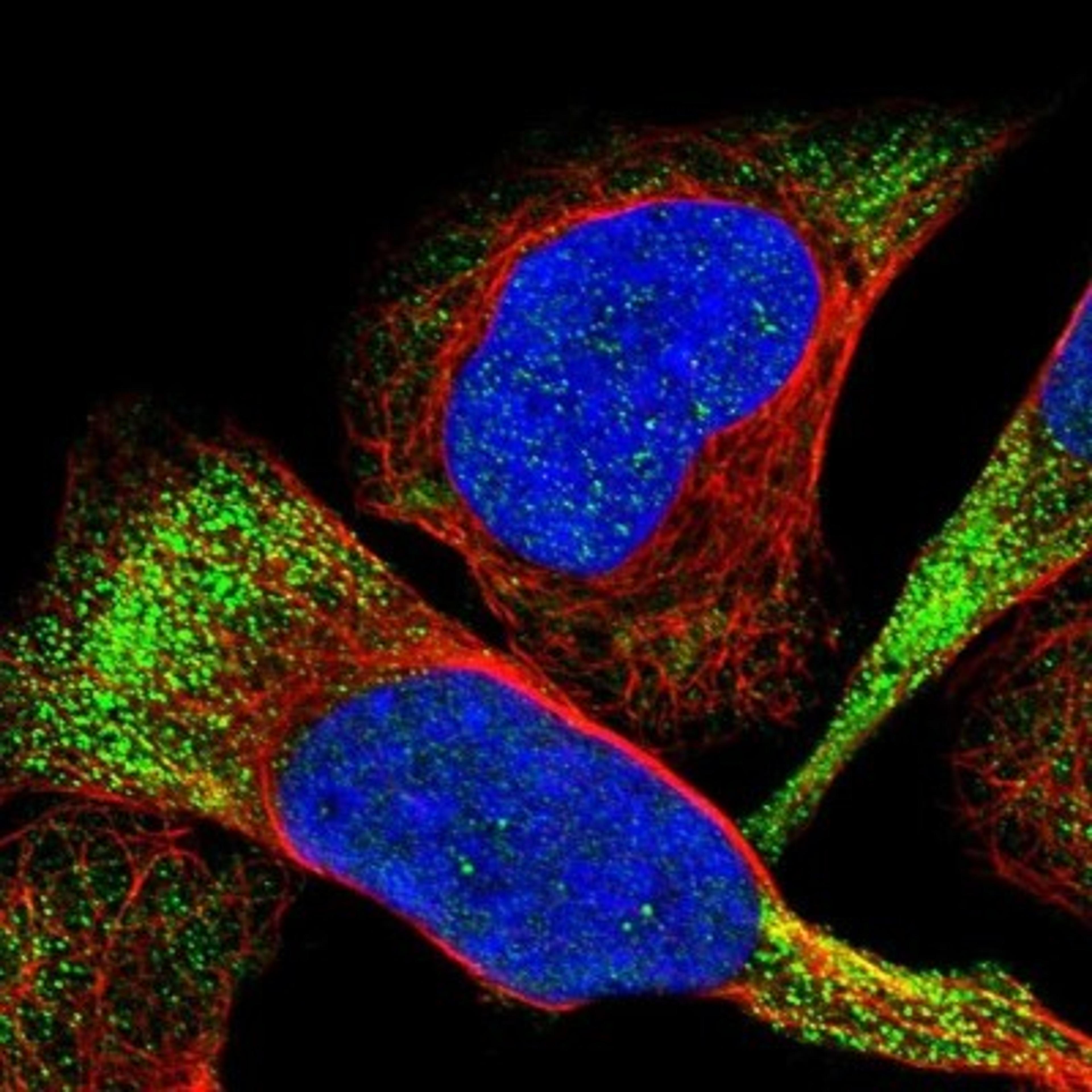 Immunocytochemistry/Immunofluorescence: C22orf40 Antibody [NBP1-81297] - Staining of human cell line U-2 OS shows positivity in cytoplasm.