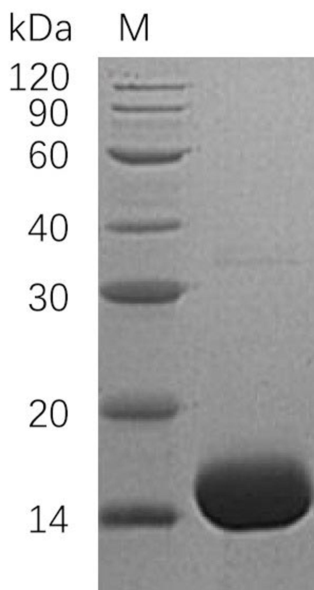 (Tris-Glycine gel) Discontinuous SDS-PAGE (reduced) with 5% enrichment gel and 15% separation gel.
