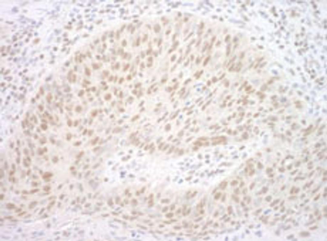 Detection of human CBX7 by immunohistochemistry.