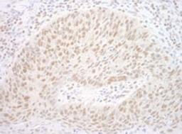 Detection of human CBX7 by immunohistochemistry.