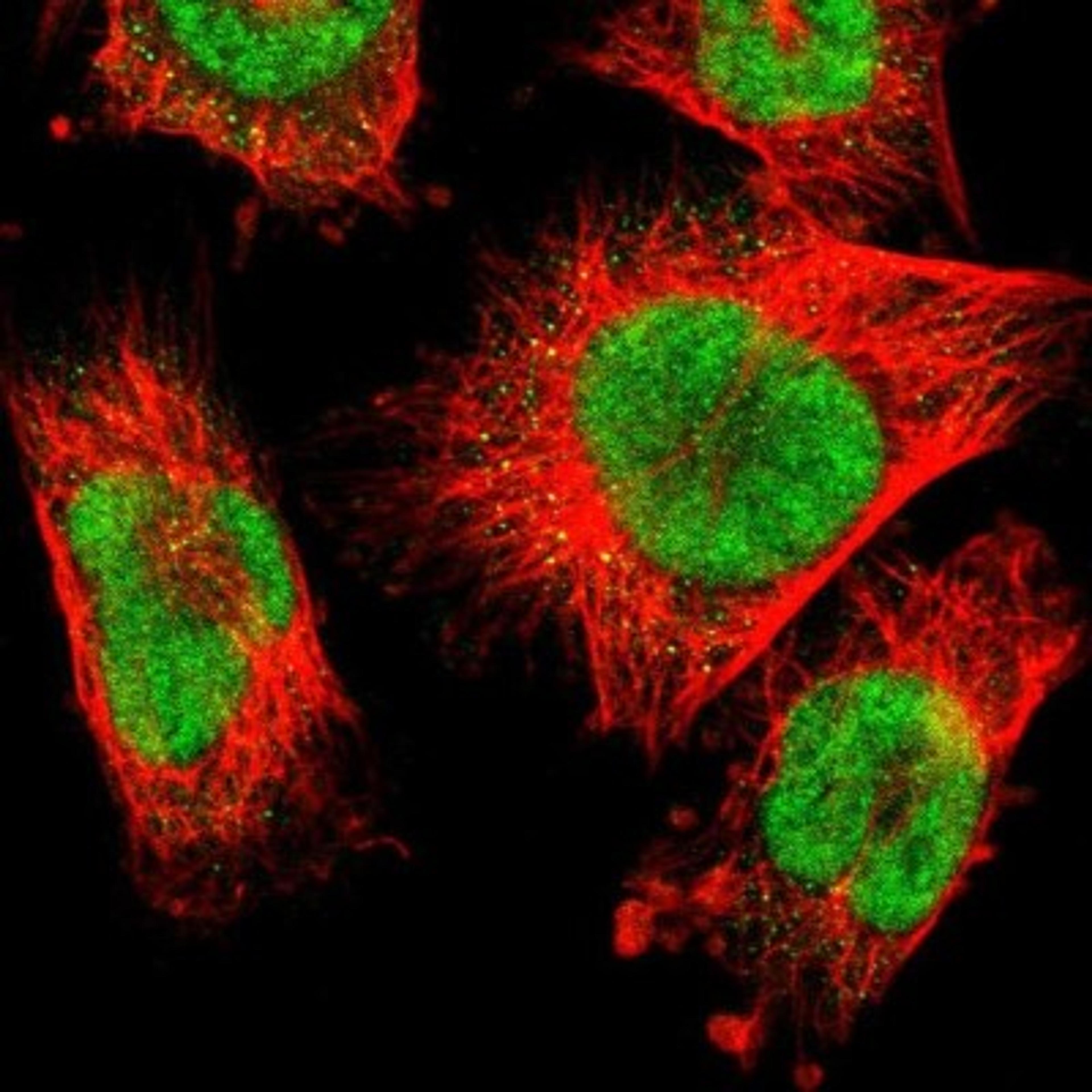 Immunocytochemistry/Immunofluorescence: RBM7 Antibody [NBP1-86080] - Immunofluorescent staining of human cell line U-251MG shows positivity in nucleus.