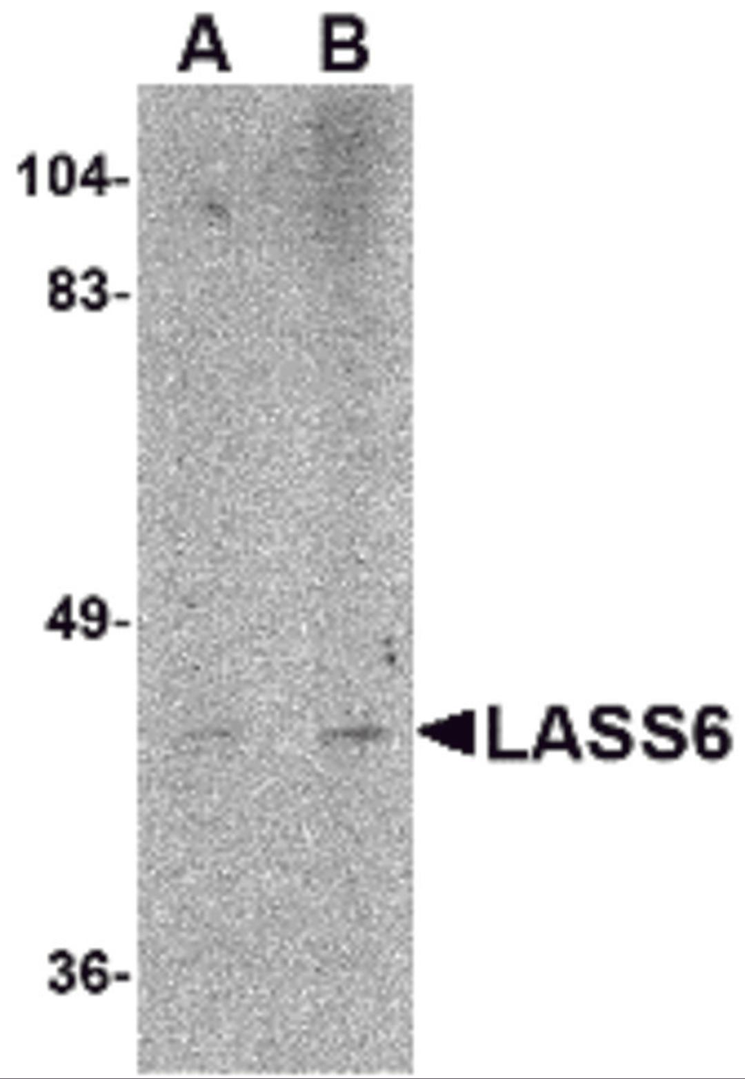 Western blot analysis of LASS6 in rat brain tissue lysate with LASS6 antibody at (A) 1 and (B) 2 &#956;g/mL.