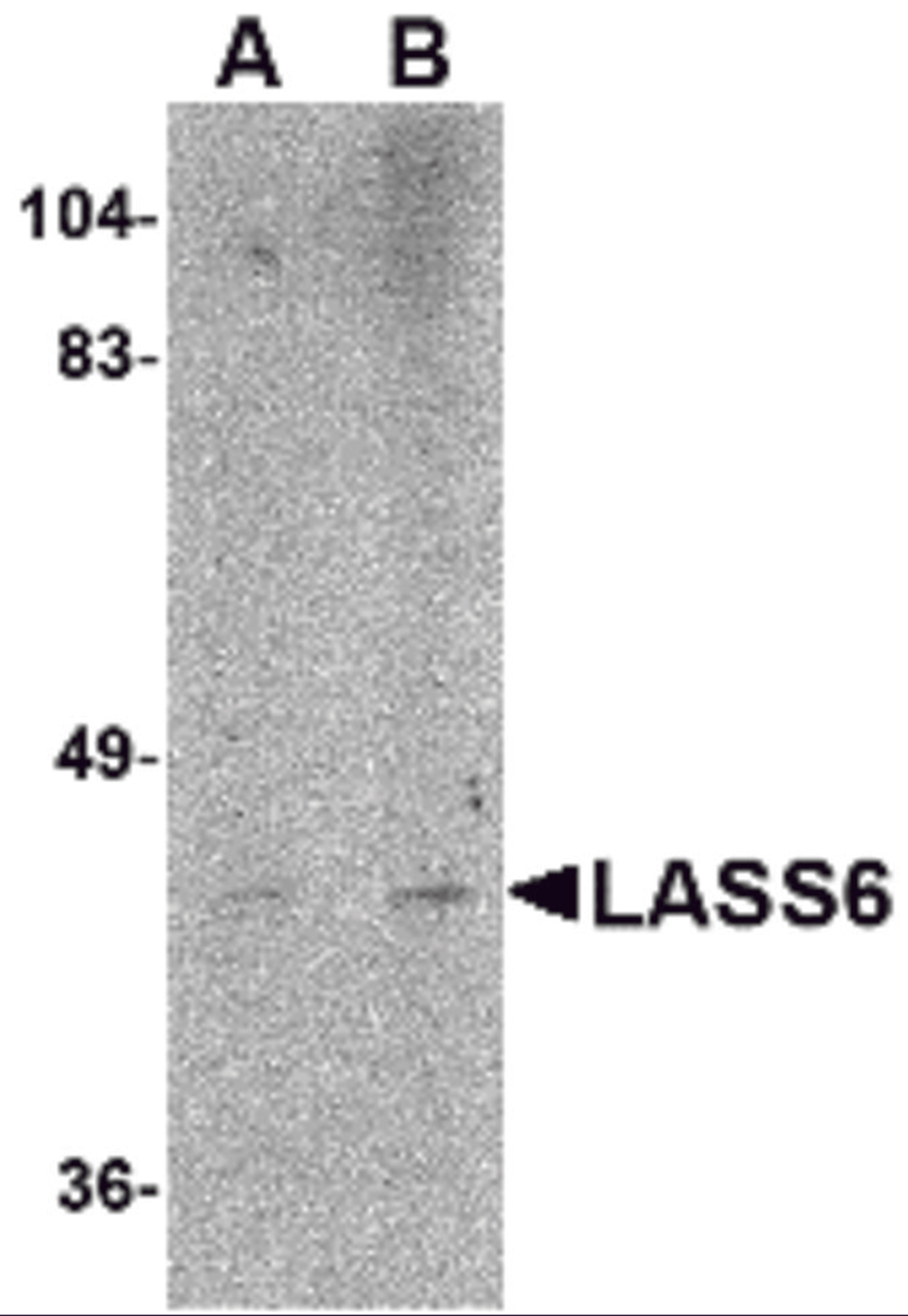 Western blot analysis of LASS6 in rat brain tissue lysate with LASS6 antibody at (A) 1 and (B) 2 &#956;g/mL.