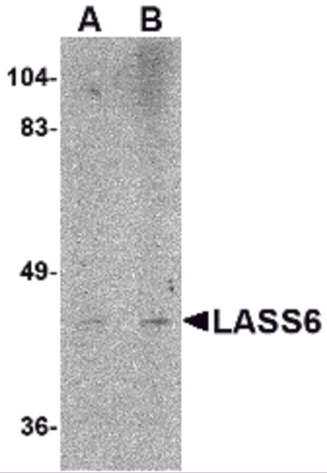 Western blot analysis of LASS6 in rat brain tissue lysate with LASS6 antibody at (A) 1 and (B) 2 μg/mL.