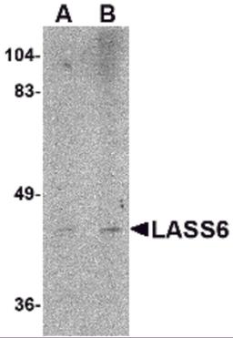 Western blot analysis of LASS6 in rat brain tissue lysate with LASS6 antibody at (A) 1 and (B) 2 μg/mL.