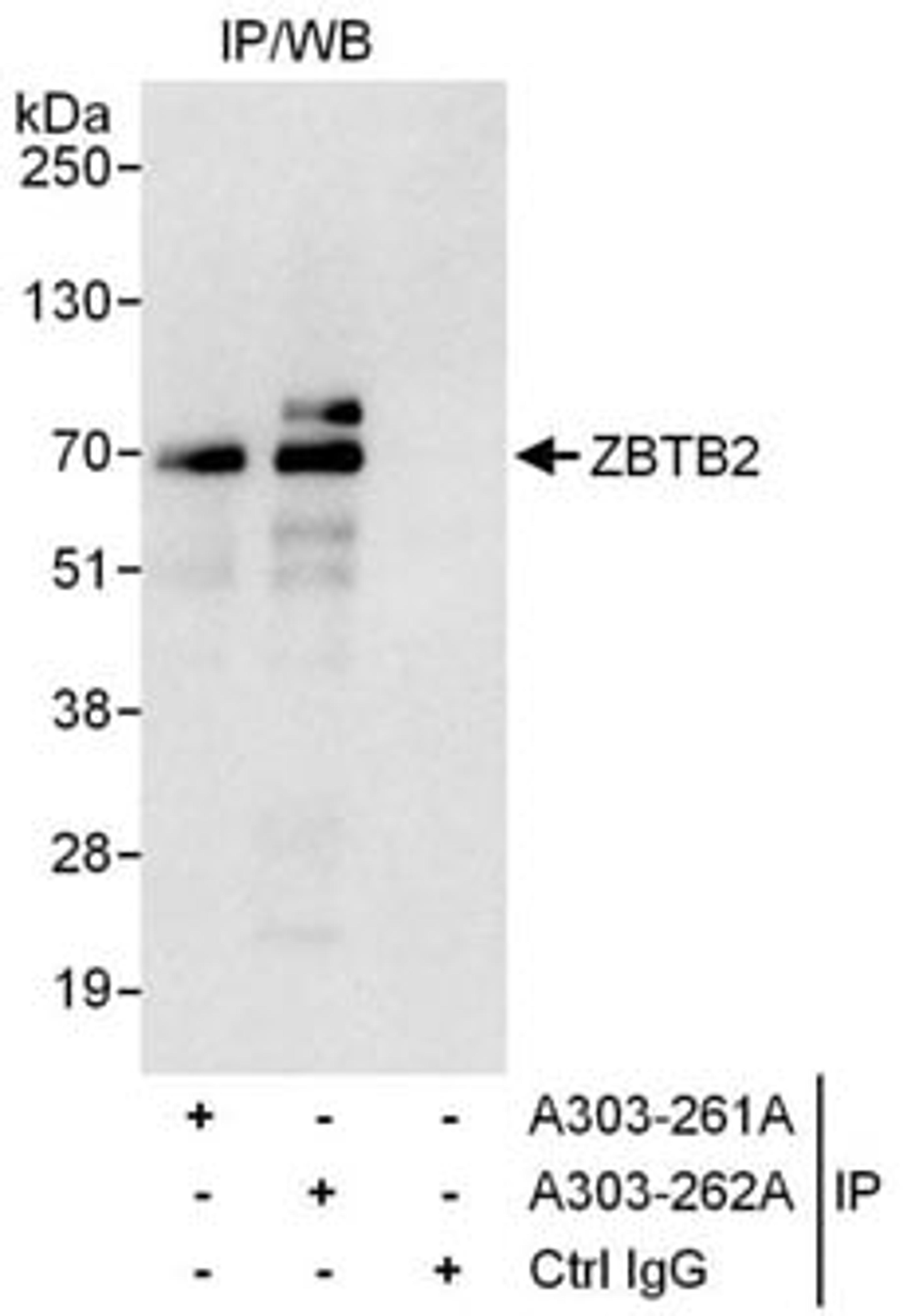 Detection of human ZBTB2 by western blot of immunoprecipitates.