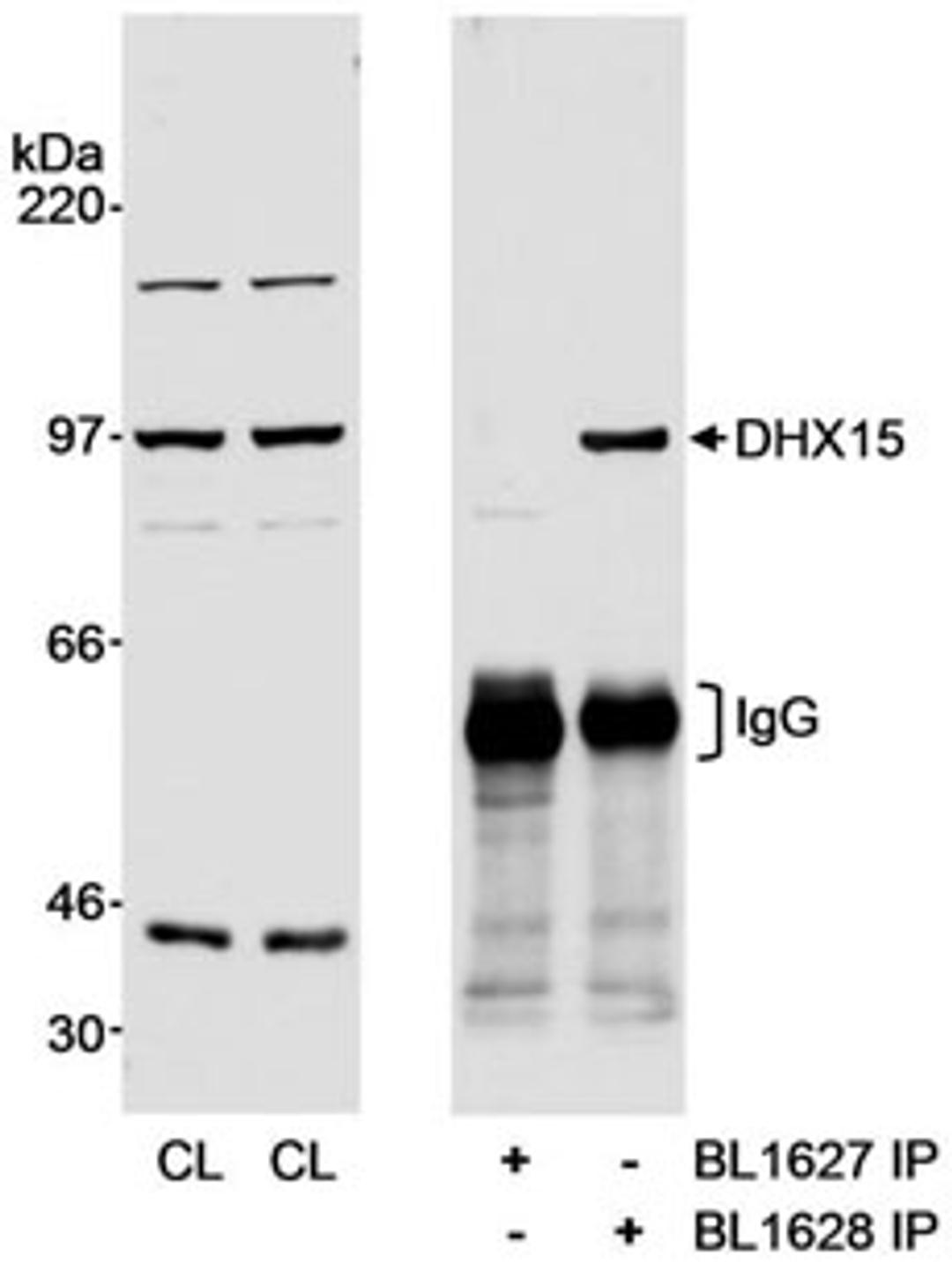 Detection of human DHX15 by western blot and immunoprecipitation.