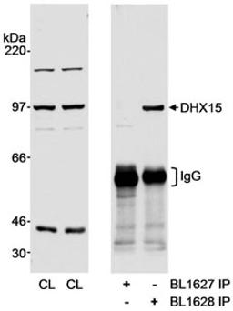 Detection of human DHX15 by western blot and immunoprecipitation.