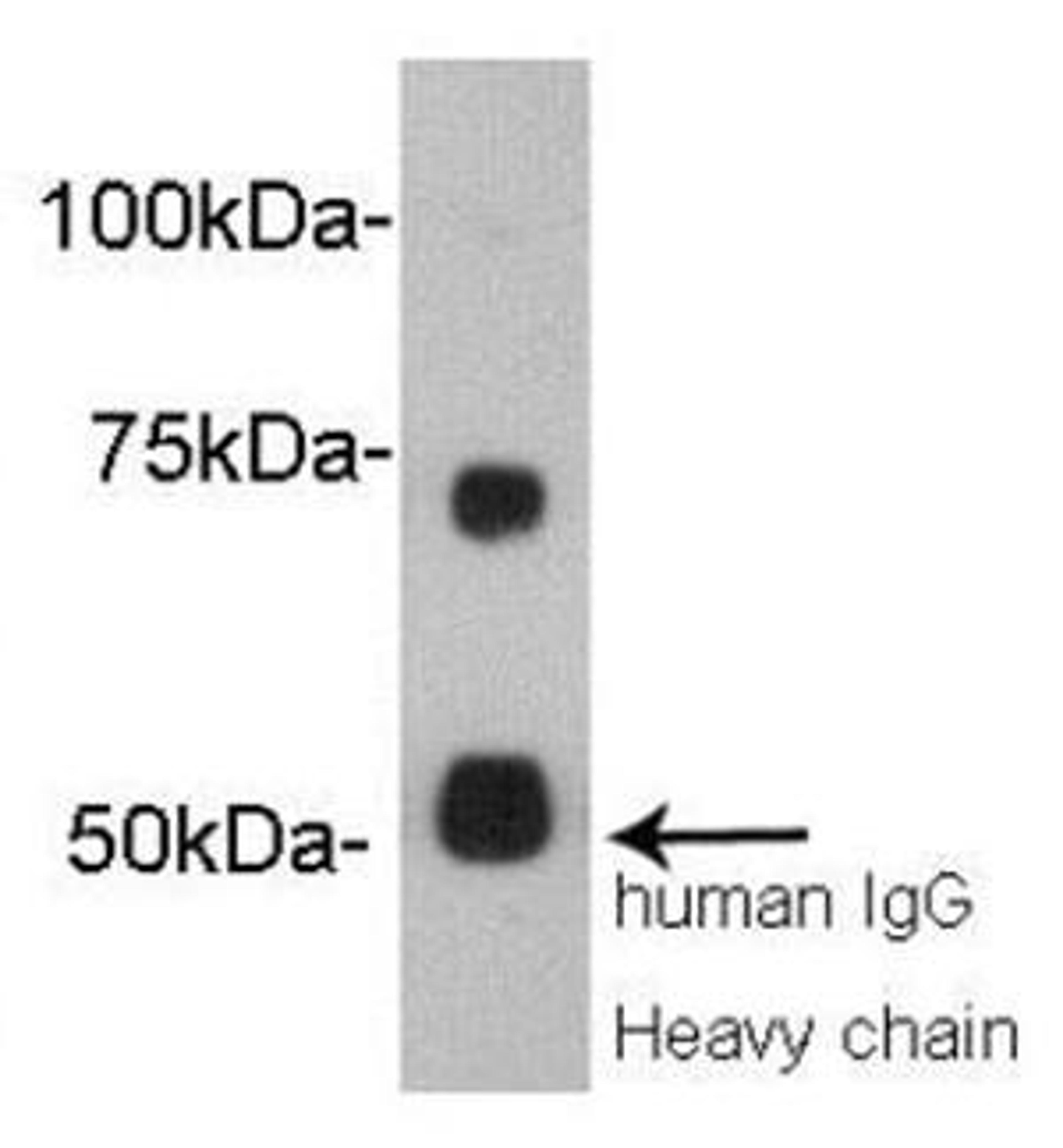 Western Blot analysis of human serum using Vitamin K-dependent protein S antibody