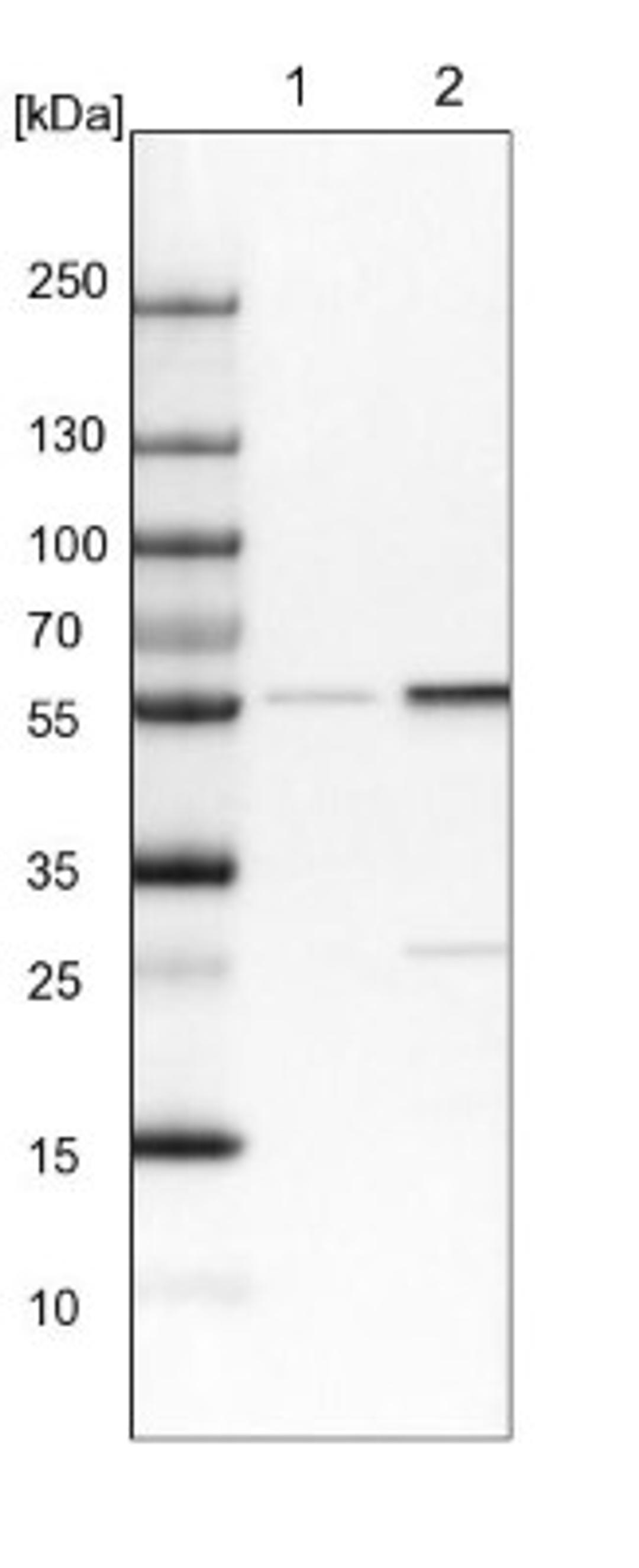 Western Blot: Lyn Antibody [NBP1-83072] - Lane 1: NIH-3T3 cell lysate (Mouse embryonic fibroblast cells)<br/>Lane 2: NBT-II cell lysate (Rat Wistar bladder tumour cells)