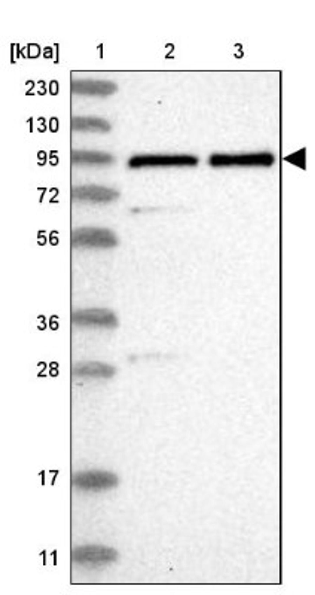 Western Blot: ZNF358 Antibody [NBP1-83861] - Lane 1: Marker [kDa] 230, 130, 95, 72, 56, 36, 28, 17, 11<br/>Lane 2: Human cell line RT-4<br/>Lane 3: Human cell line U-251MG sp