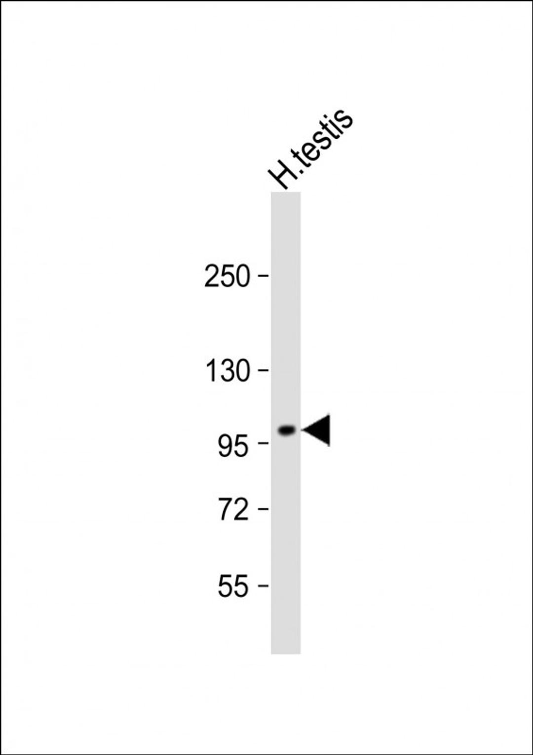 Western Blot at 1:1000 dilution + H. testis whole cell lysate Lysates/proteins at 20 ug per lane.