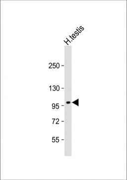 Western Blot at 1:1000 dilution + H. testis whole cell lysate Lysates/proteins at 20 ug per lane.