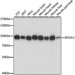 Western blot - AFG3L2 antibody (A15393)