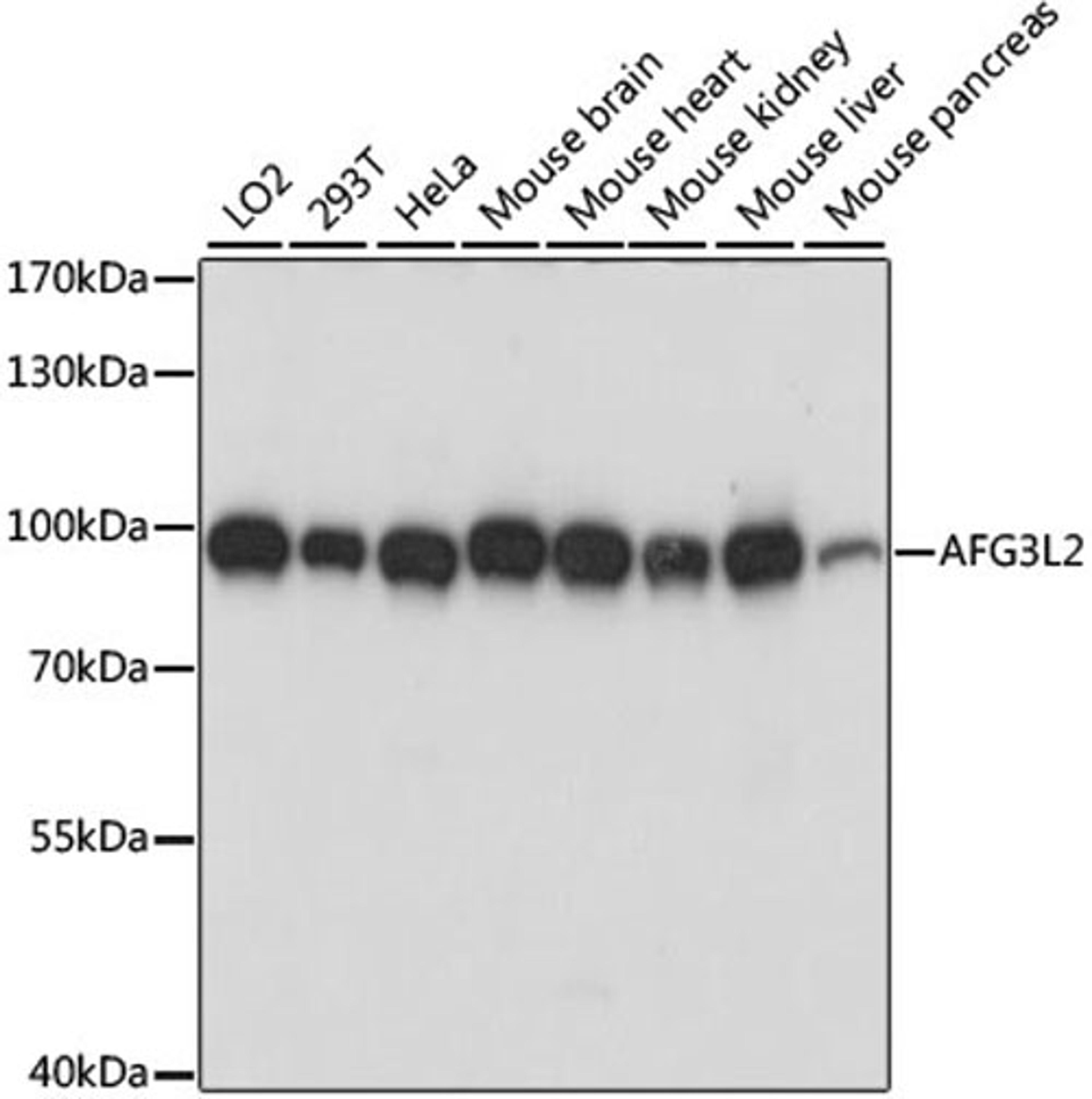 Western blot - AFG3L2 antibody (A15393)