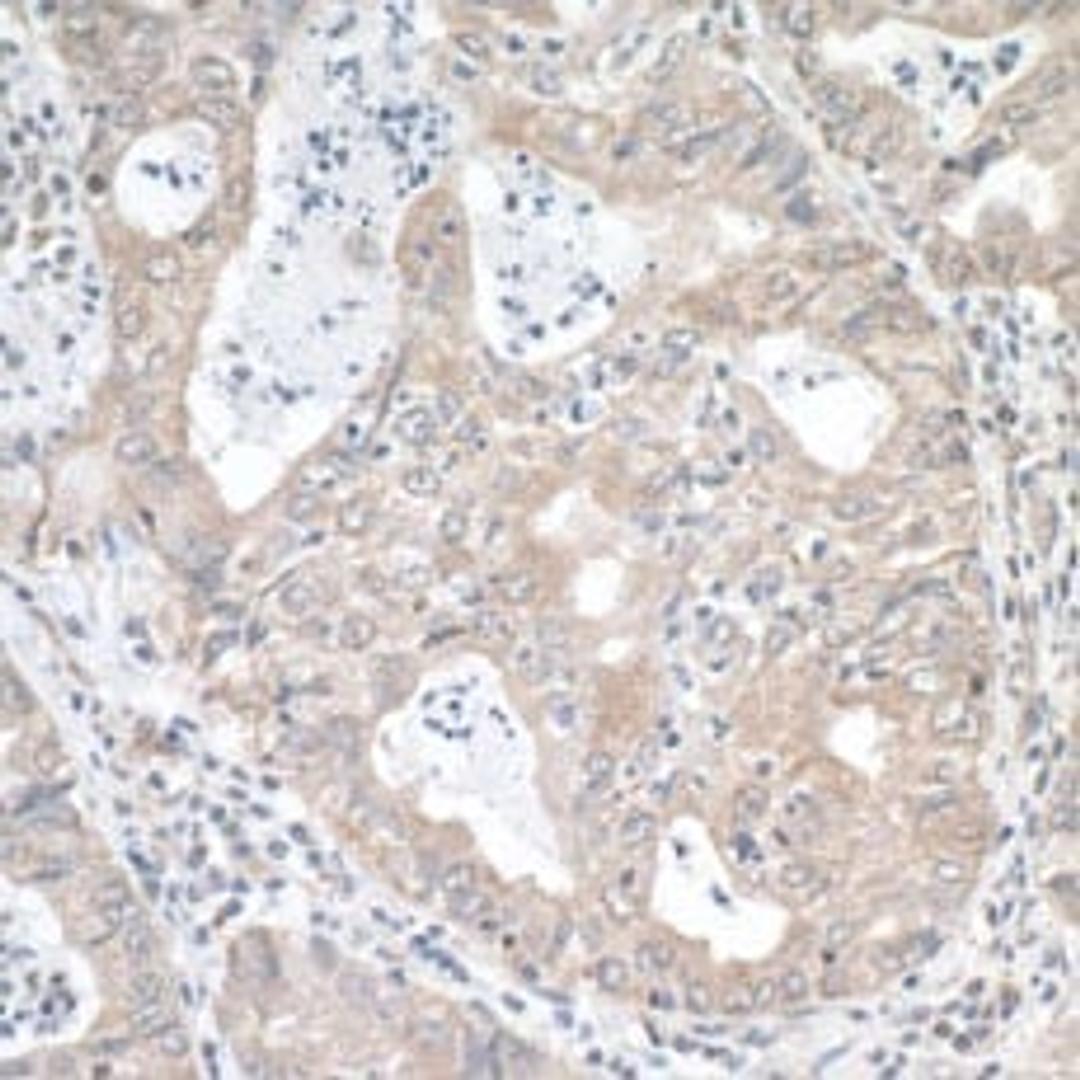 Detection of human MTHFR by immunohistochemistry.